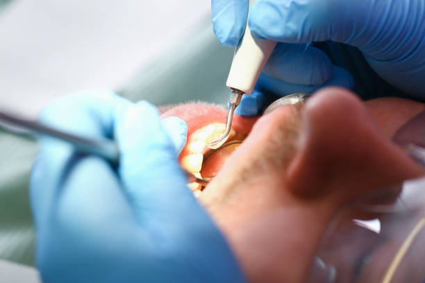 Best Cracked Tooth Emergency Dentist  in Bellwood, IL